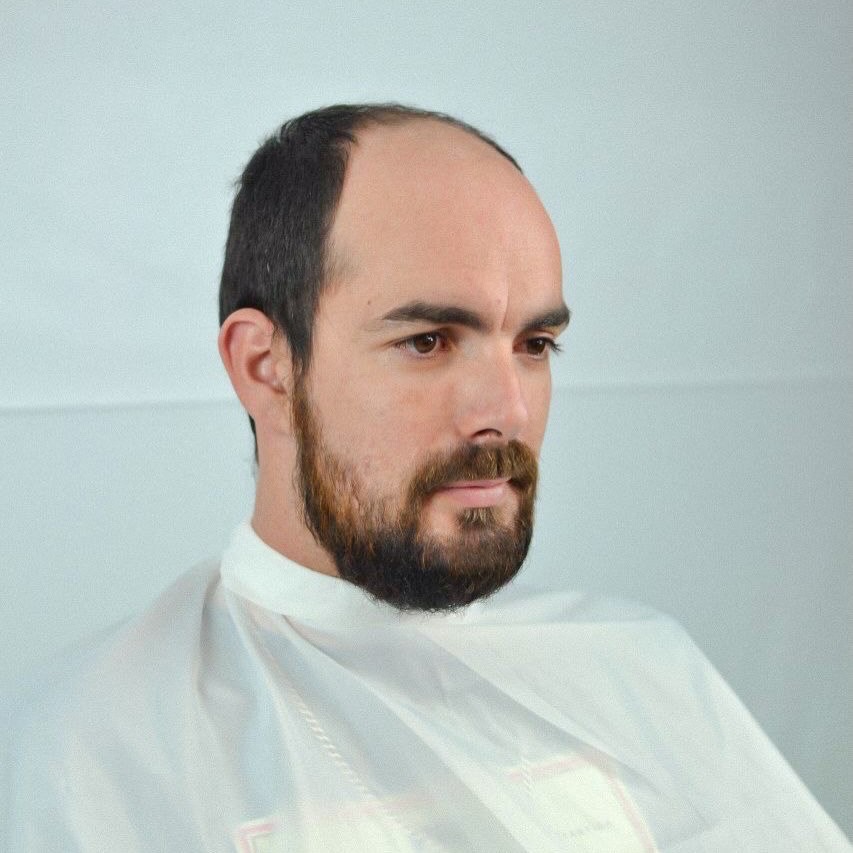 Cliente sentado na cadeira, com capa de corte, antes do procedimento de prótese capilar